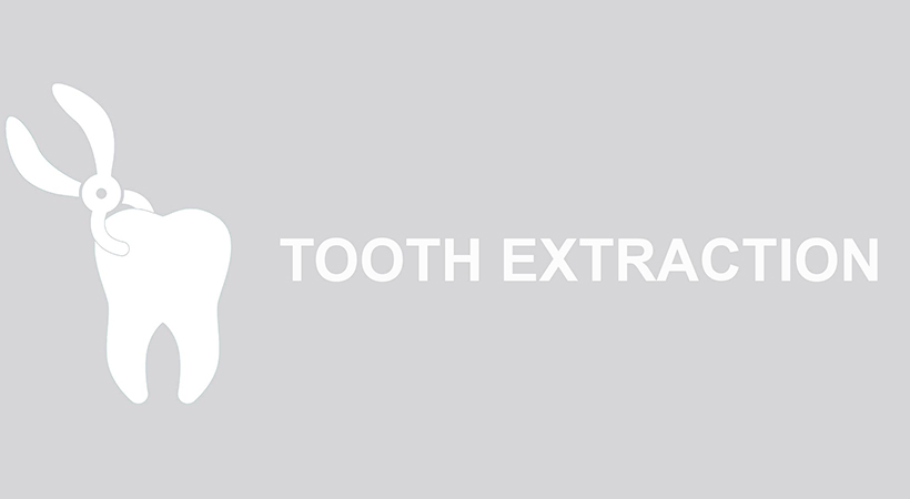 Tooth Extraction