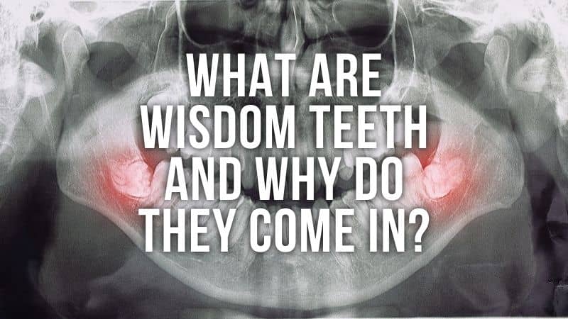 What Are Wisdom Teeth And Why Do They Come In?