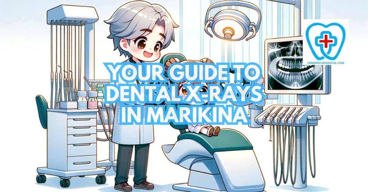 Dental X-Rays in Marikina