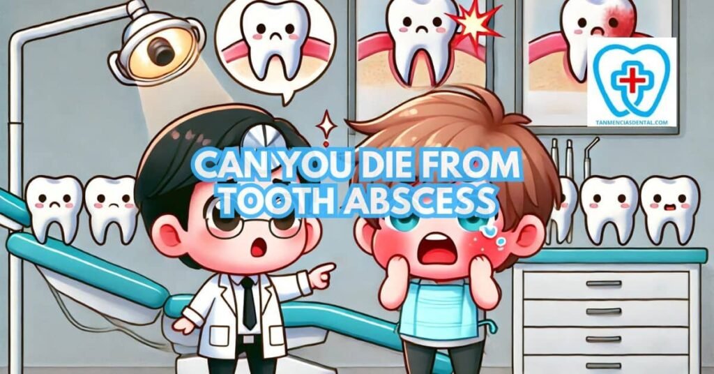Can You Die From a Tooth Abscess? Understanding the Risks and Symptoms