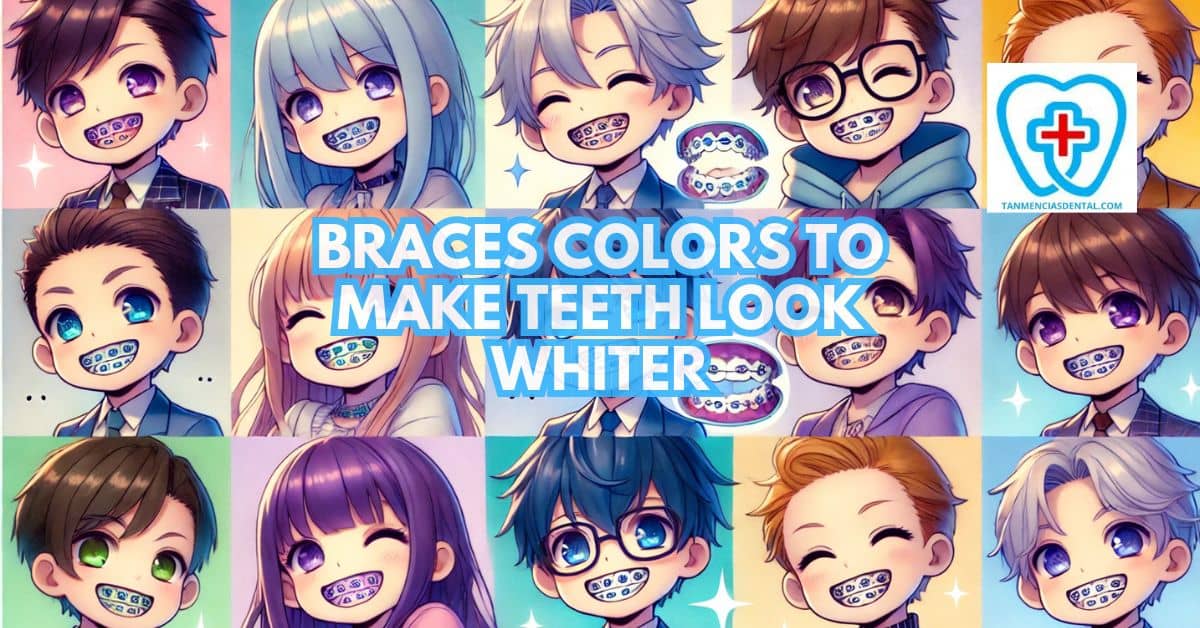 Braces Colors To Make Teeth Look Whiter