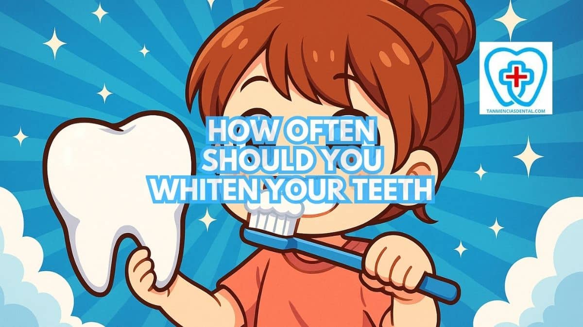 How Often Should You Whiten Your Teeth