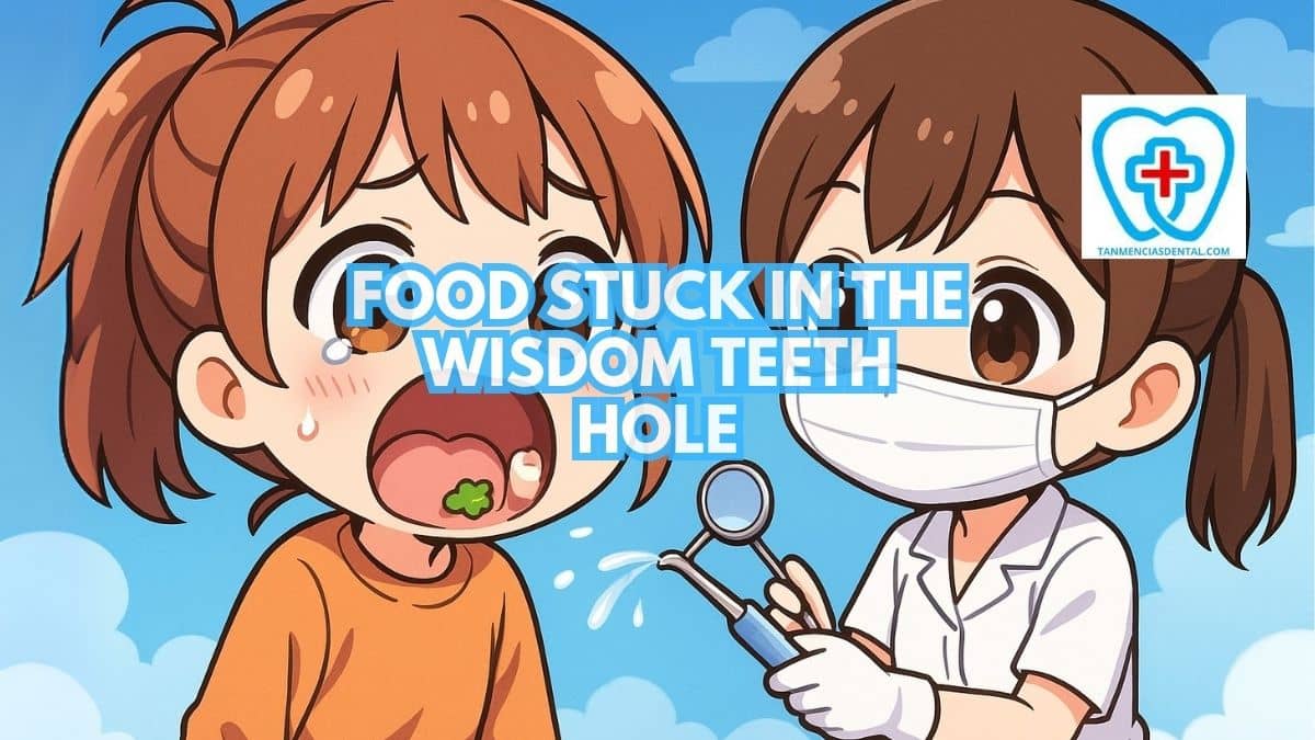 Food Stuck In the Wisdom Teeth Hole