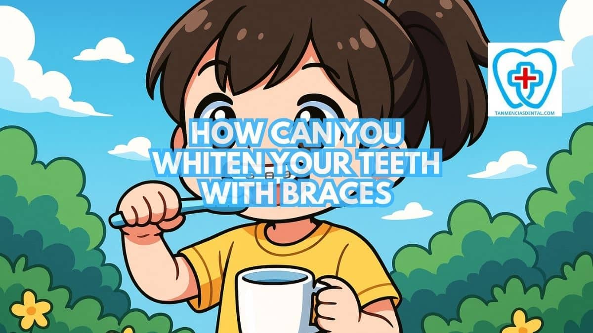 How Can You Whiten Your Teeth With Braces